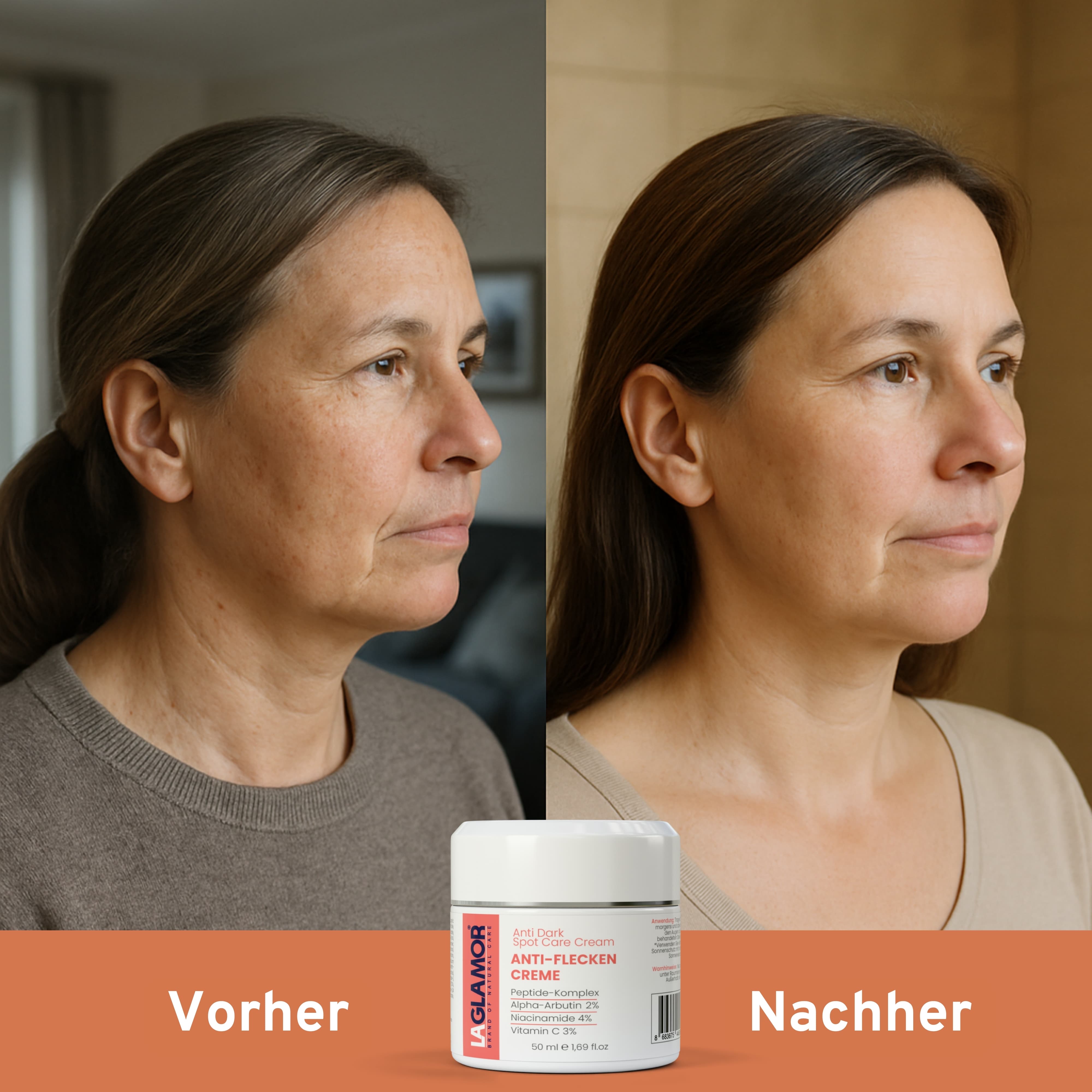 LAGLAMOR® Anti-Flecken Creme - 50ml